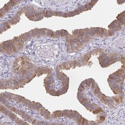 Retinol Binding Protein RBP Antibody, Novus Biologicals 0.1mL; Unlabeled:Antibodies