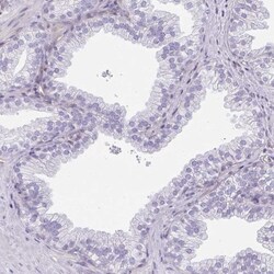 Retinol Binding Protein RBP Antibody, Novus Biologicals 0.1mL; Unlabeled:Antibodies