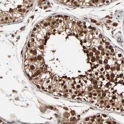 RhoJ Antibody, Novus Biologicals 0.1mL; Unlabeled:Antibodies, Polyclonal