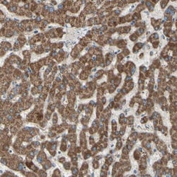 Rhot1 Antibody, Novus Biologicals 0.1mL; Unlabeled:Antibodies, Polyclonal
