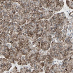 Rhot1 Antibody, Novus Biologicals 0.1mL; Unlabeled:Antibodies, Polyclonal