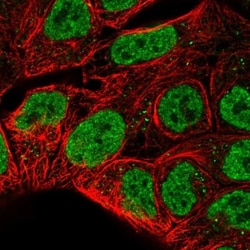 Ribonuclease A Antibody, Novus Biologicals™