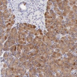 Ribonuclease A Antibody, Novus Biologicals 25 &mu;L; Unlabeled:Antikroppar