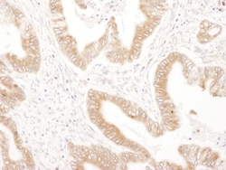 Ribophorin II Antibody, Novus Biologicals 0.1mg; Unlabeled:Antibodies,