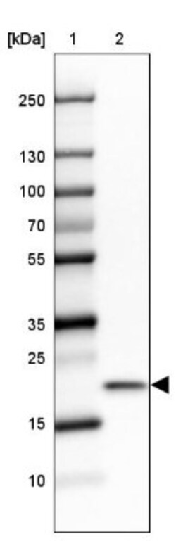 Ribosomal Protein L24 Antibody, Novus Biologicals 0.1mL; Unlabeled:Antibodies,