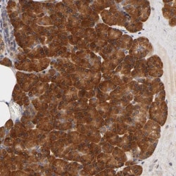 Ribosomal Protein S29 Antibody, Novus Biologicals:Antibodies:Primary Antibodies