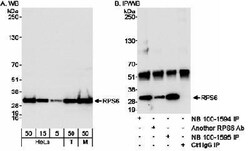 Ribosomal Protein S6/RPS6 Antibody, Novus Biologicals 0.1mL; Unlabeled:Antibodies,