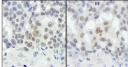 Rif1 Antibody, Novus Biologicals 100 &mu;L | Buy Online | Novus Biologicals | Fisher Scientific