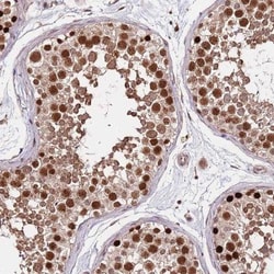 Rif1 Antibody, Novus Biologicals:Antibodies:Primary Antibodies