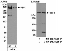 Rif1 Antibody, Novus Biologicals 0.1mL; Unlabeled:Antibodies, Polyclonal