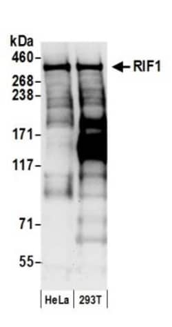 Rif1 Antibody, Novus Biologicals 0.1mL; Unlabeled:Antibodies, Polyclonal