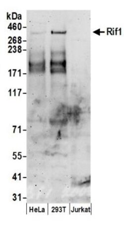 Rif1 Antibody, Novus Biologicals 100 &mu;L | Buy Online | Novus Biologicals | Fisher Scientific