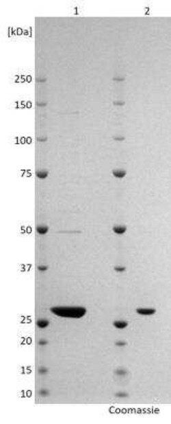 Novus Biologicals Recombinant Virus Rift Valley Fever Virus Nucleocapsid ZH-548 His (N-Term) Protein 0.5 mg | Buy Online | Novus Biologicals | Fisher Scientific