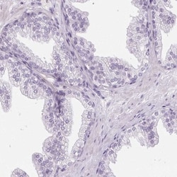 Ropporin 1-like Antibody, Novus Biologicals 25 &mu;L; Unlabeled:Antibodies,