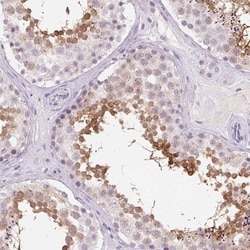 Ropporin 1-like Antibody, Novus Biologicals 25 &mu;L; Unlabeled:Antibodies,