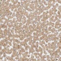Roquin Antibody, Novus Biologicals:Antibodies:Primary Antibodies