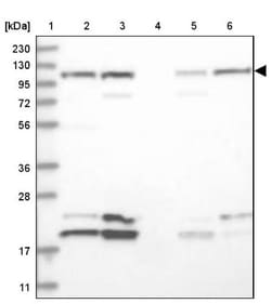 Rpn2 Antibody, Novus Biologicals 0.1mL; Unlabeled:Antibodies, Polyclonal