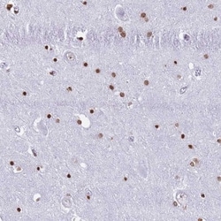 Ryk Antibody, Novus Biologicals 0.1mL; Unlabeled:Antibodies, Polyclonal