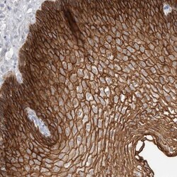 S100 calcium binding protein A14 Antibody, Novus Biologicals 0.1mL; Unlabeled:Antibodies,