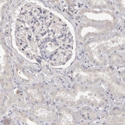 S100 calcium binding protein A14 Antibody, Novus Biologicals 0.1mL; Unlabeled:Antibodies,