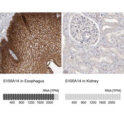 S100 calcium binding protein A14 Antibody, Novus Biologicals 0.1mL; Unlabeled:Antibodies,