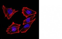 Mouse anti-S100A1, Clone: 4C4.9 + S100A1/1012, Novus Biologicals 0.2mg;