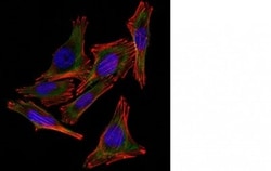 Mouse anti-S100A1, Clone: 4C4.9 + S100A1/1012, Novus Biologicals 0.2mg;