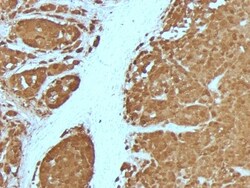 Mouse anti-S100A1, Clone: 4C4.9 + S100A1/1012, Novus Biologicals 0.2mg;