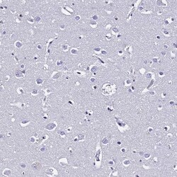 S100A11 Antibody, Novus Biologicals 0.1mL; Unlabeled:Antibodies, Polyclonal
