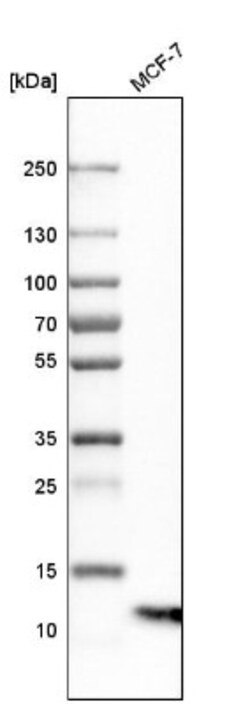 S100A13 Antibody, Novus Biologicals 25 &mu;L | Buy Online | Novus Biologicals | Fisher Scientific