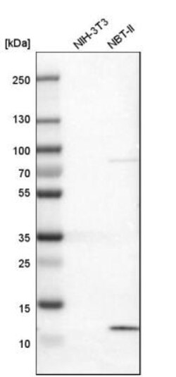 S100A13 Antibody, Novus Biologicals 25 &mu;L | Buy Online | Novus Biologicals | Fisher Scientific