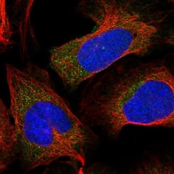 S100A16 Antibody, Novus Biologicals 0.1mL; Unlabeled:Antibodies, Polyclonal