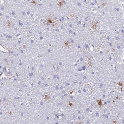 S100A16 Antibody, Novus Biologicals 0.1mL; Unlabeled:Antibodies, Polyclonal