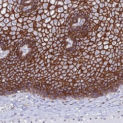 S100A16 Antibody, Novus Biologicals 0.1mL; Unlabeled:Antibodies, Polyclonal