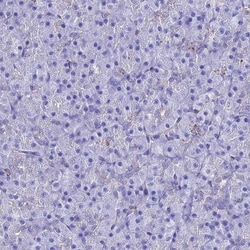 S100A16 Antibody, Novus Biologicals 0.1mL; Unlabeled:Antibodies, Polyclonal