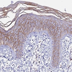 S100A16 Antibody, Novus Biologicals 0.1mL; Unlabeled:Antibodies, Polyclonal