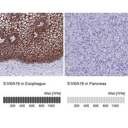 S100A16 Antibody, Novus Biologicals 0.1mL; Unlabeled:Antibodies, Polyclonal