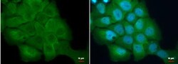 S100A2 Antibody, Novus Biologicals 0.1mL; Unlabeled:Antibodies, Polyclonal