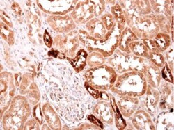 S100A2 Antibody, Novus Biologicals 0.1mL; Unlabeled:Antibodies, Polyclonal