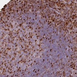 S100A4 Antibody, Novus Biologicals 0.1mL; Unlabeled:Antibodies, Polyclonal