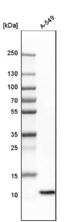 S100A4 Antibody, Novus Biologicals 0.1mL; Unlabeled:Antibodies, Polyclonal