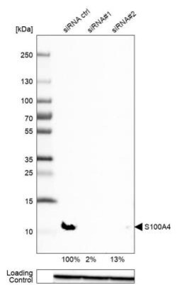 S100A4 Antibody, Novus Biologicals 0.1mL; Unlabeled:Antibodies, Polyclonal