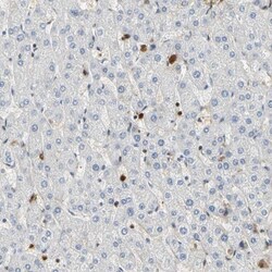 S100A6 Antibody, Novus Biologicals:Antibodies:Primary Antibodies