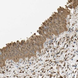 S100A6 Antibody, Novus Biologicals:Antibodies:Primary Antibodies