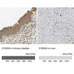 S100A6 Antibody, Novus Biologicals:Antibodies:Primary Antibodies