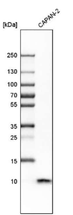 S100A6 Antibody, Novus Biologicals:Antibodies:Primary Antibodies