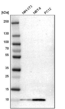 S100A6 Antibody, Novus Biologicals:Antibodies:Primary Antibodies