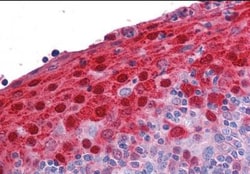 S100A7/Psoriasin Antibody, Novus Biologicals 0.1mg; Unlabeled:Antibodies,