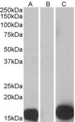 S100A7/Psoriasin Antibody, Novus Biologicals 0.1mg; Unlabeled:Antibodies,