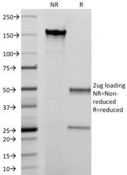 S100A9 Antibody (MAC387), Novus Biologicals 0.2mg; Unlabeled:Antibodies,